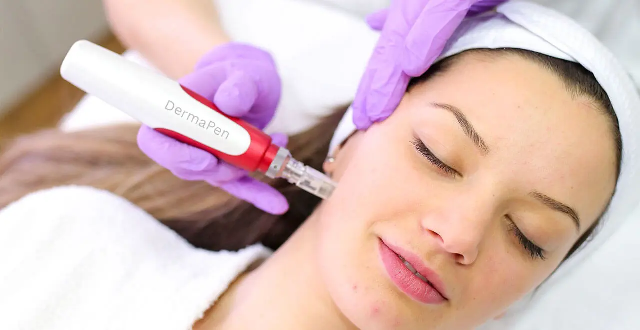 Dettaglio procedura Needling medico con biostimolazione