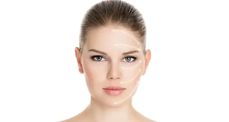Trattamento Radiesse filler biostimolante - Dott.ssa Claudia Ascia
